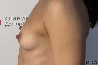 Фото пациенток до/после