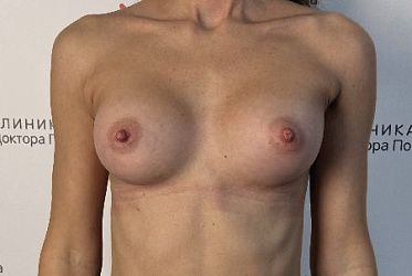 Фото пациенток до/после