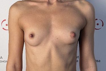 Фото пациенток до/после