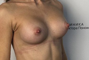 Фото пациенток до/после